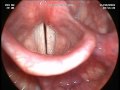 les cordes vocales :  larynx