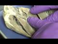 Heart anatomy, pericardium, myocardium, epicardium