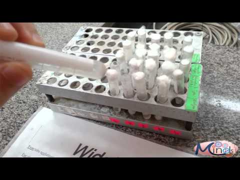 how to perform widal test