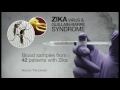 ジカ熱とギラン・バレー症候群に関連の疑い ジカ熱