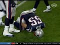 Juniour Seau Breaks His Arm