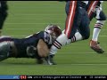 Juniour Seau Breaks His Arm