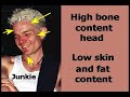 Why stupid people are called boneheads
