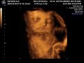 my first baby\ my first baby\