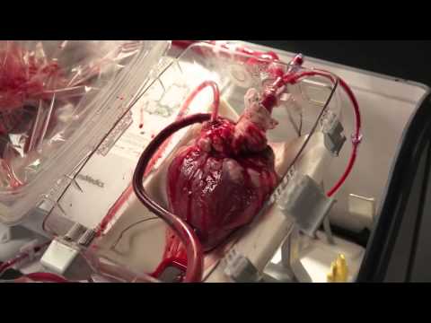 Вчені розробили прилад який дозволяє жити серцю поза тілом (ВІДЕО)