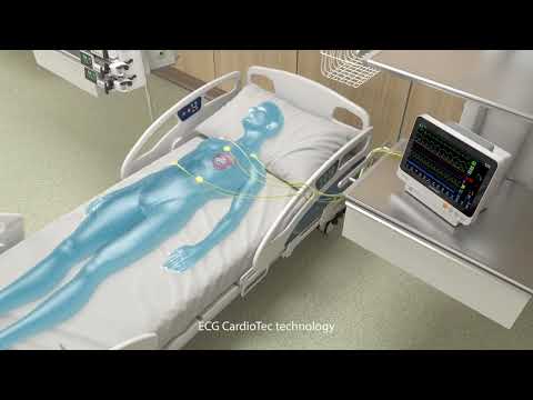 Мониторы пациента