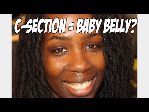 how to fit tummy after c section