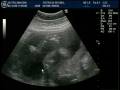 videos de Rodrigo_3o_Ultrasom - 04122008