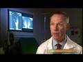 Rheumatoid Arthritis Overview