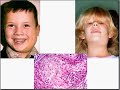 Medical School Pathology, Chapter 8k