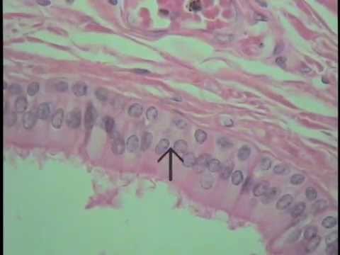 how to locate epididymis
