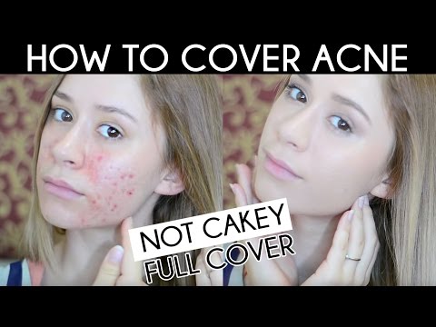 how to hide acne