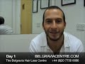 Hair Loss Treatment Video Diary Month 1 - Diya