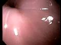 my vore vid1