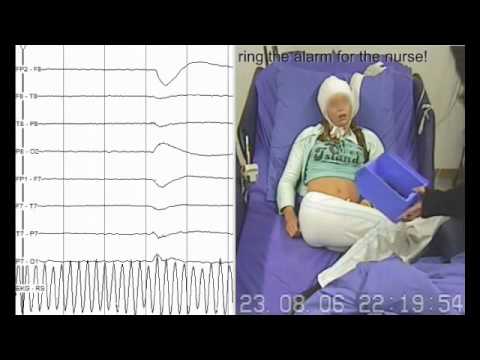 how to perform eeg test