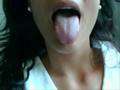 Halitosis y metabolismo de carbohidratos