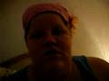 Ehlers danlos syndrome