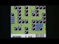 classic game room reviews dig dug for nintendo game boy released in 1992 (based on the 1982 arcade machine). dig dug for gameboy has two versions of dig dug, the arcade original and 