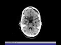 DICOM PARA POWER POINT (2/2)