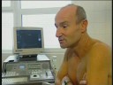 Nyaralás mellé hepatitis A? Nyaralás mellé hepatitis A?