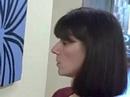 DALLAS FEMALE HAIR TRANSPLANT: DEBBIE\