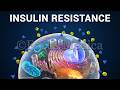 Insulin Resistance