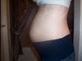 Pregnancy Week 18 Doppler Video