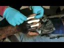 ASHI Basic First Aid - Major Burns ASHI Basic First Aid - Major Burns
