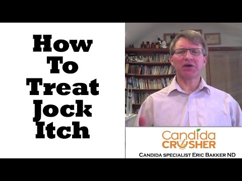 how to treat jock itch