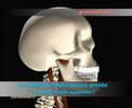 Burning Mouth Syndrome
