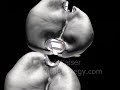 3d Dental Animation - Canaletas - Frank Kaiser 3d Dental Animation - Canaletas - Frank Kaiser