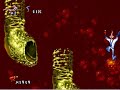 intestinal Distress