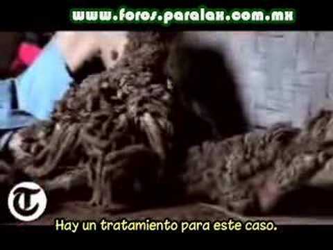 Imagen de previsualización de YouTube