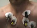My Echocardiogram My Echocardiogram