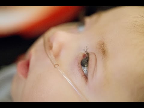 how to treat krabbe disease