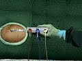 Virtual Surgeon: open heart