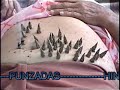 moxibustion vientre -02-