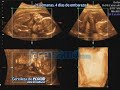 21 Semanas, 4 días de embarazo