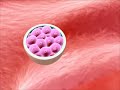 implantation