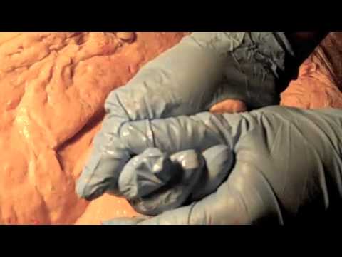 how to treat udder edema