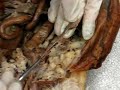 Uterine horns before pregnancy