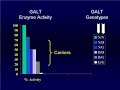 Galactosemia D/G variant