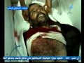 Suhail TV   October 15 مشاهد مؤلمة 05 لشهداء وجرحى مجزرة قوات صالح في السبت