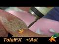 ActiveFX(活躍)+DeepFX(深層)TotalFX飛點CO2雷射磨皮除痘疤Part1