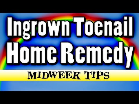 how to get rid ingrown toenail infection