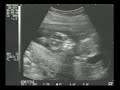 procedimientos sobre abortos 2ª parte