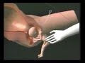 procedimientos sobre abortos 2ª parte