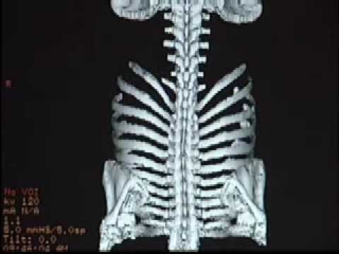 CT Scan