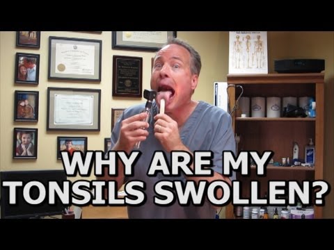 how to relieve swollen tonsils