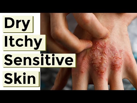 how to avoid dry skin